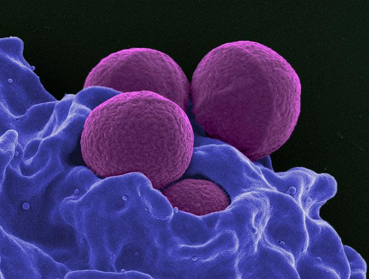 Types of infection including MRSA, C. diff, E-Coli, and diarrhoea causes overview infographic