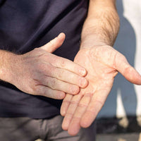 Child's cracked hands damaged from excessive use of 70% alcohol sanitizer illustrating destroying your skin
